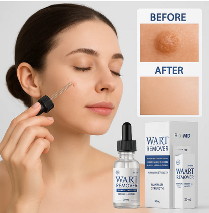 WART REMOVER Removedor de Verrugas y Lunares⭐| ENVÍO GRATIS