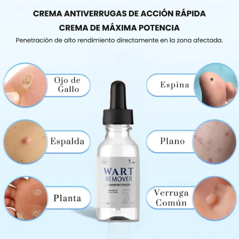 WART REMOVER Removedor de Verrugas y Lunares⭐| ENVÍO GRATIS