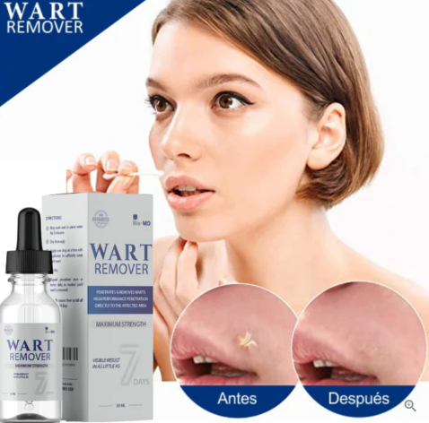WART REMOVER Removedor de Verrugas y Lunares⭐| ENVÍO GRATIS